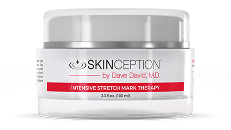 skinception-intensive-stretch-mark-therapy-460×260-1